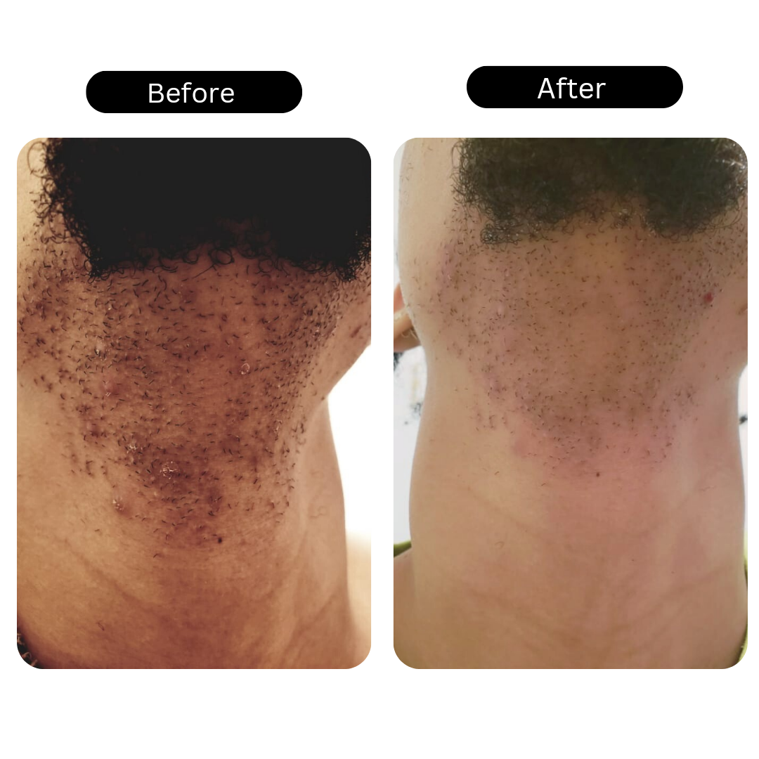 Rejuvenating Facial Serum